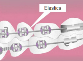 Elastics